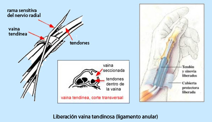 Que tomar para las articulaciones y tendones